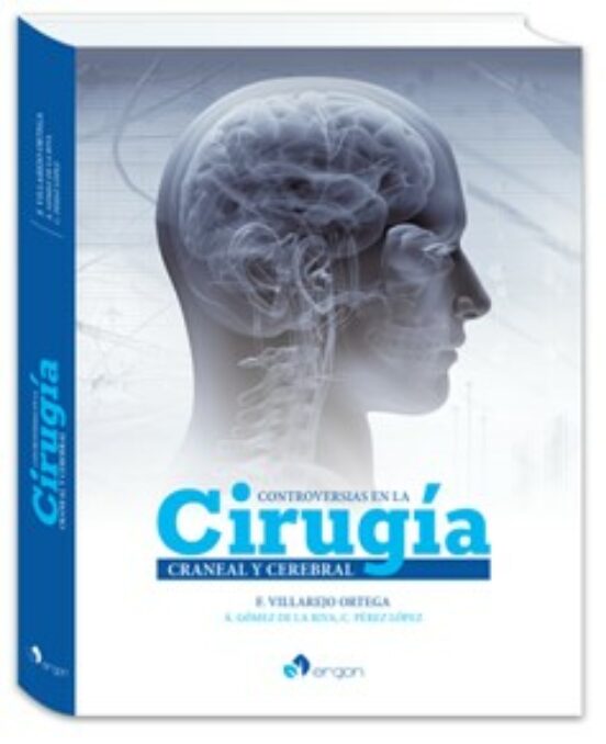 Controversias En La Cirugía Craneal Y Cerebral