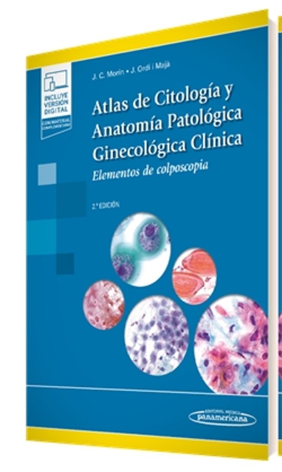 Atlas De Citología Y Anatomia Patologia 2ª Edicion
