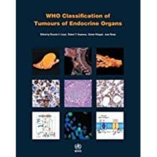 Who Classification Of Tumours Of Endocrine Organs