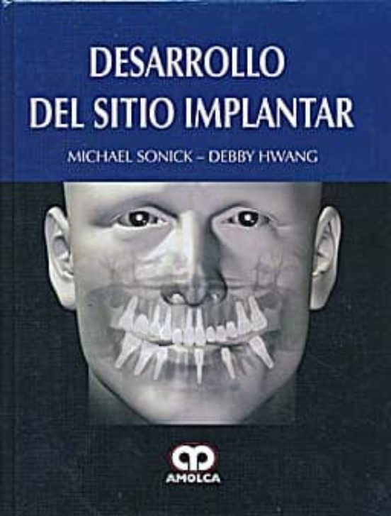 Desarrollo Del Sitio Implantar
