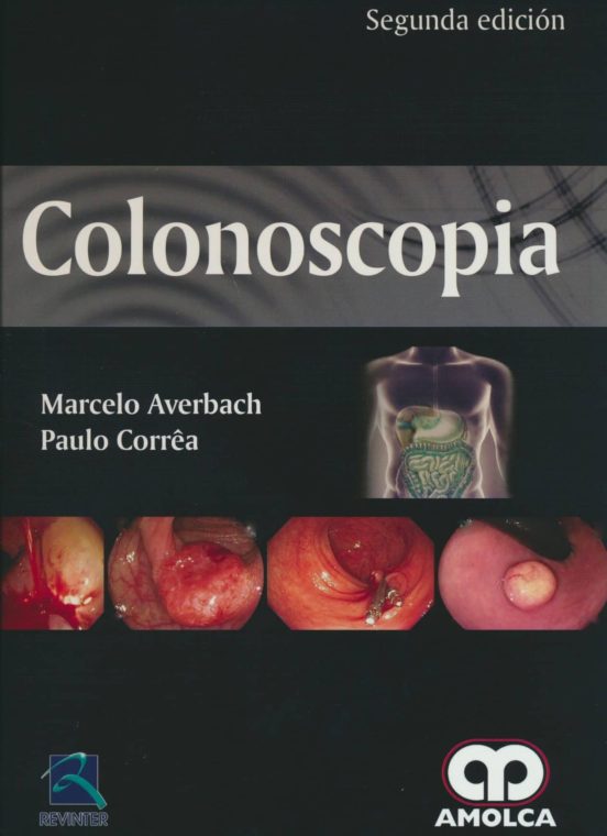 Colonoscopia
