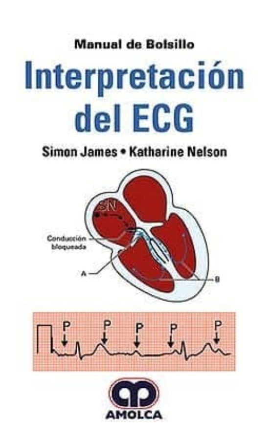 Interpretacion Del Ecg