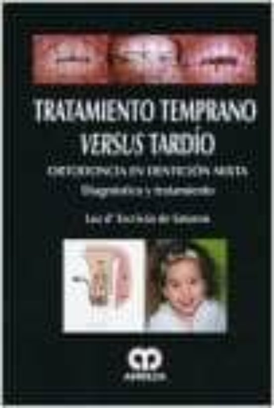 Tratamiento Temprano Versus Tardio: Ortodoncia En Denticion Mixta : Di