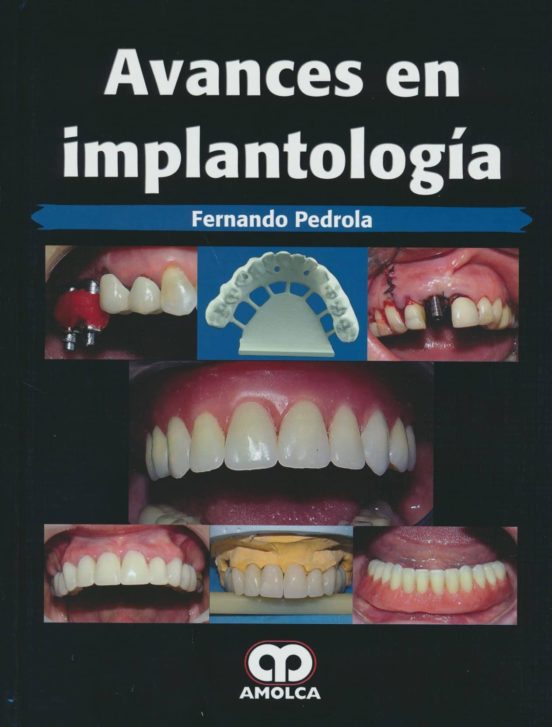 Avances En Implantologia