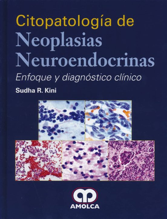 Citopatologia De Neoplasias Neuroendocrinas: Enfoque Y Diagnostico Cli