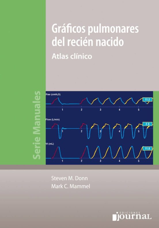 Graficos Pulmonares Del Recien Nacido