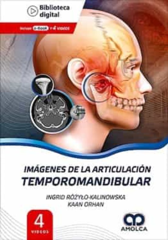 Imagenes De La Articulacion Temporomandibular