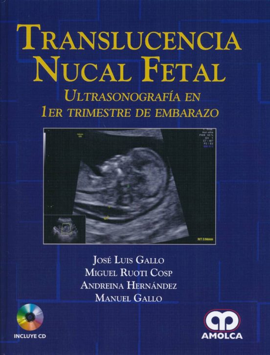 Translucencia Nucal Fetal: Ultrasonografia En 1er Trimestre De Embaraz