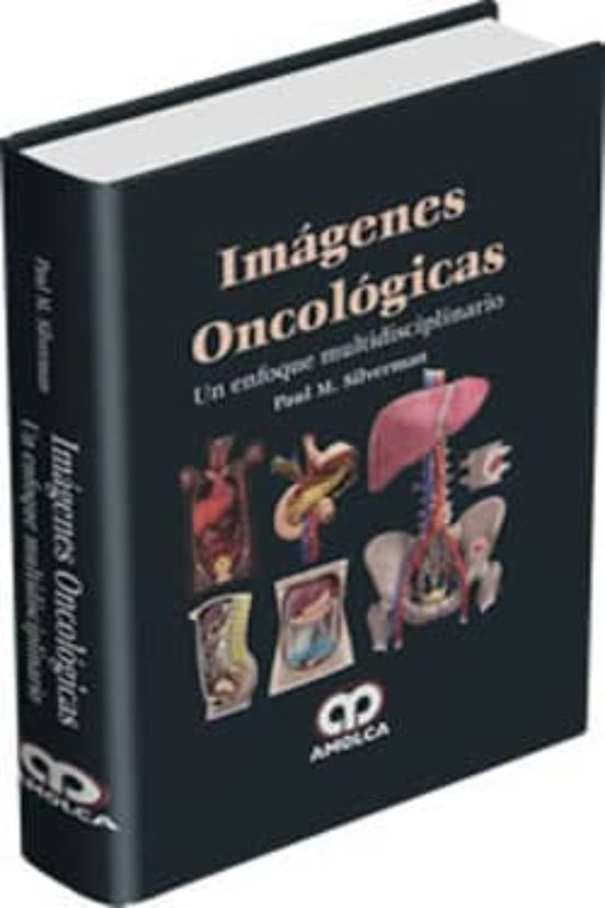 Imagenes Oncologicas. Un Enfoque Multidisciplinario