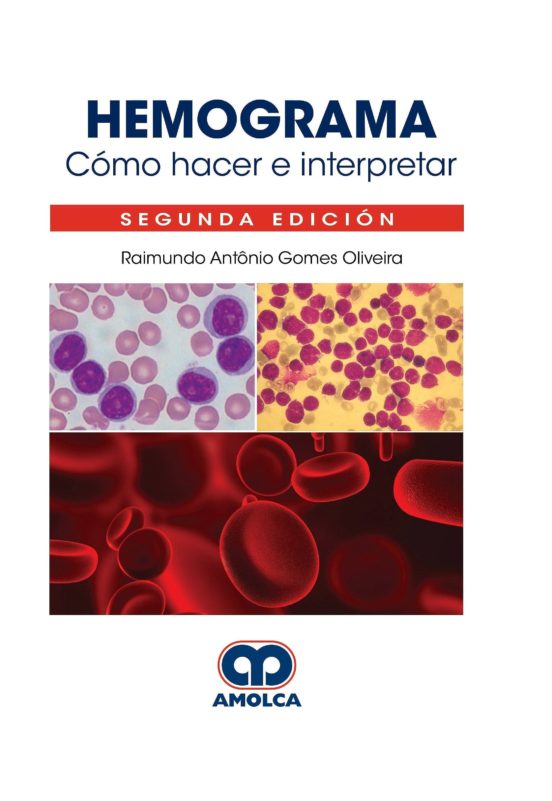 Hemograma. Cómo Hacer E Interpretar