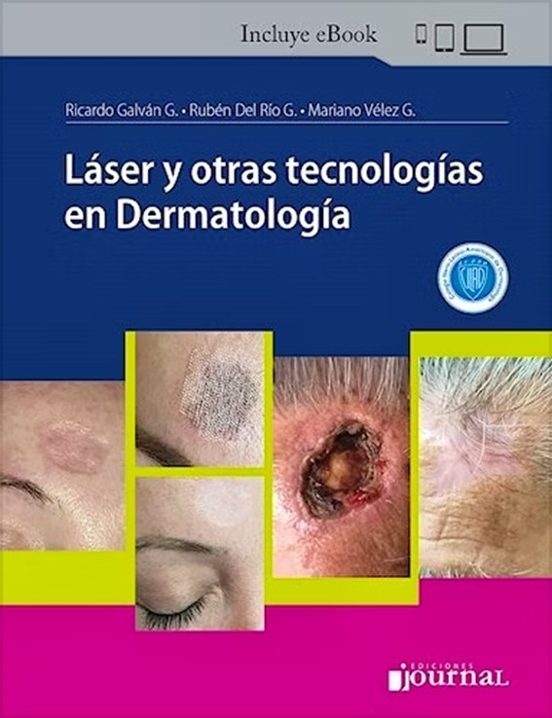 Láser Y Otras Tecnologías En Dermatología