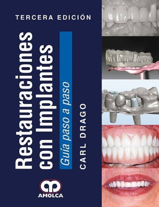 Restauraciones Con Implantes 2017