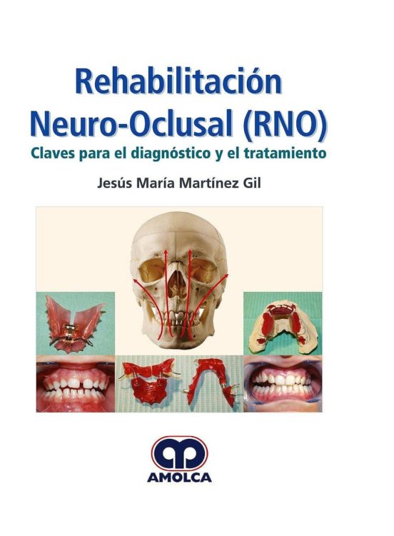 Rehabilitacion Neuro-oclusal : Claves Para El Diagnostico Y Trata