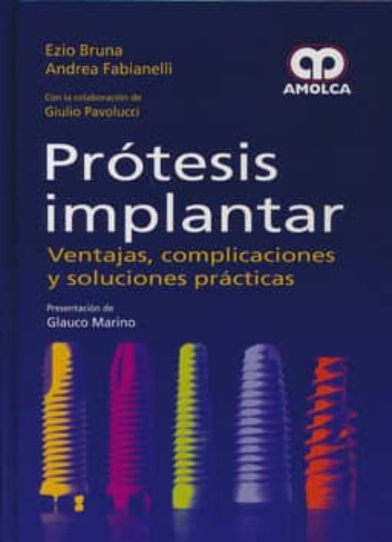Protesis Implantar: Ventajas Complicaciones Y Soluciones Practicas