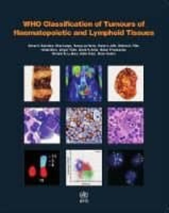 Who Classification Of Tumours Of Haematopoietic And Lymphoid Tissues