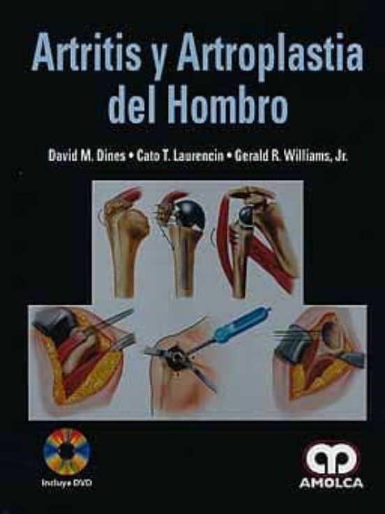 Artritis Y Artroplastia Del Hombro + Dvd