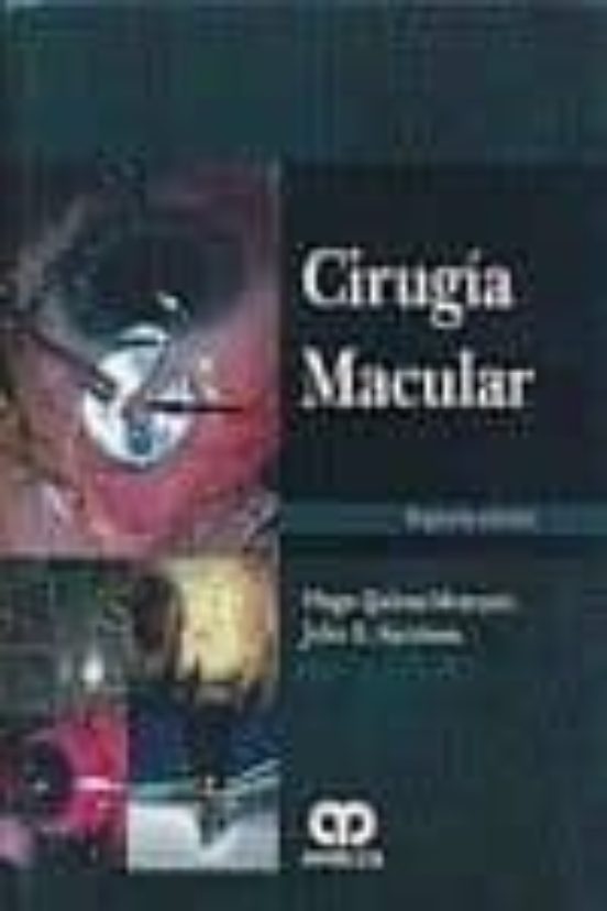 Cirugia Macular