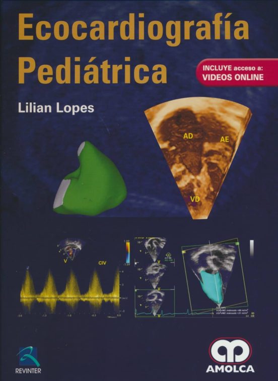 Ecocardiografia Pediatrica