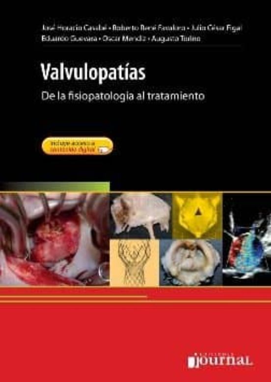 Valvulopatias: De La Fisiopatologia Al Tratamiento + Acceso Onlin E