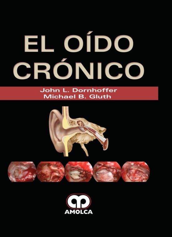 El Oido Cronico