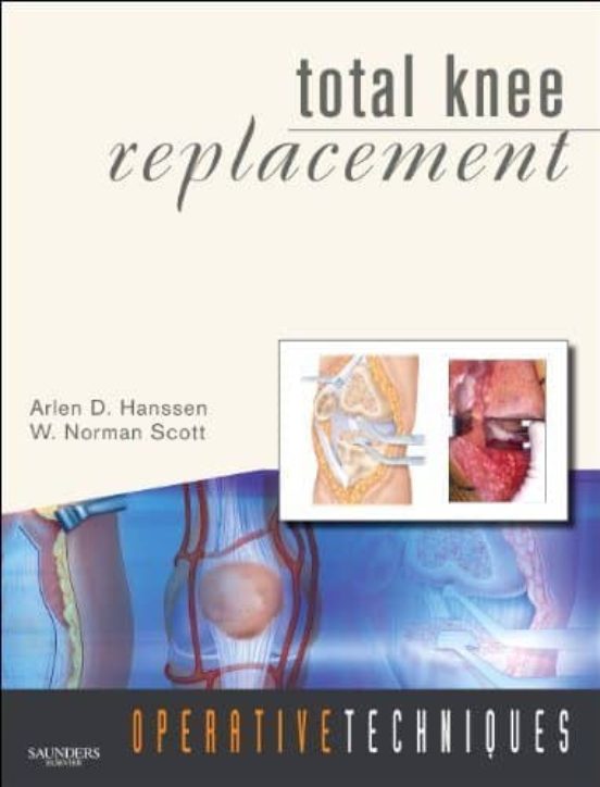 Total Knee Replacement