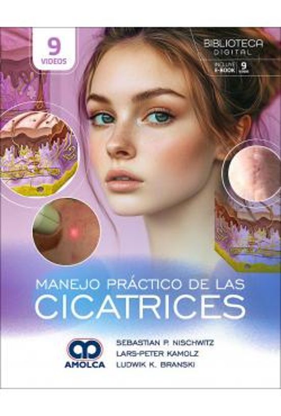 Manejo Práctico De Las Cicatrices