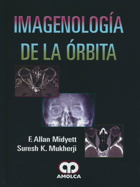 Imagenologia De La Orbita