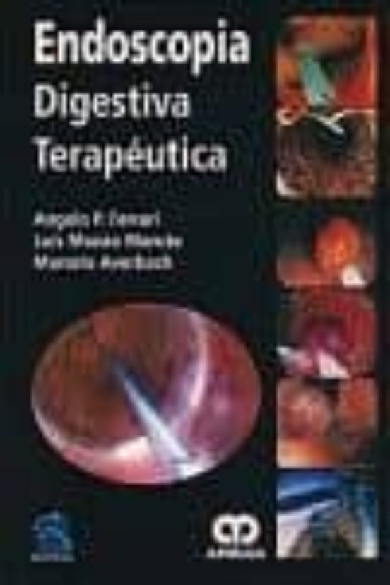 Endoscopia Digestiva Terapeutica
