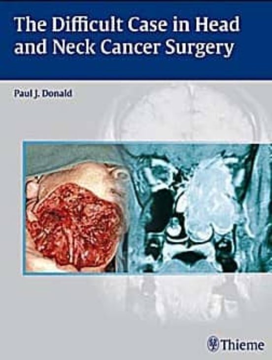 The Difficult Case In Head And Neck Cancer Surgery