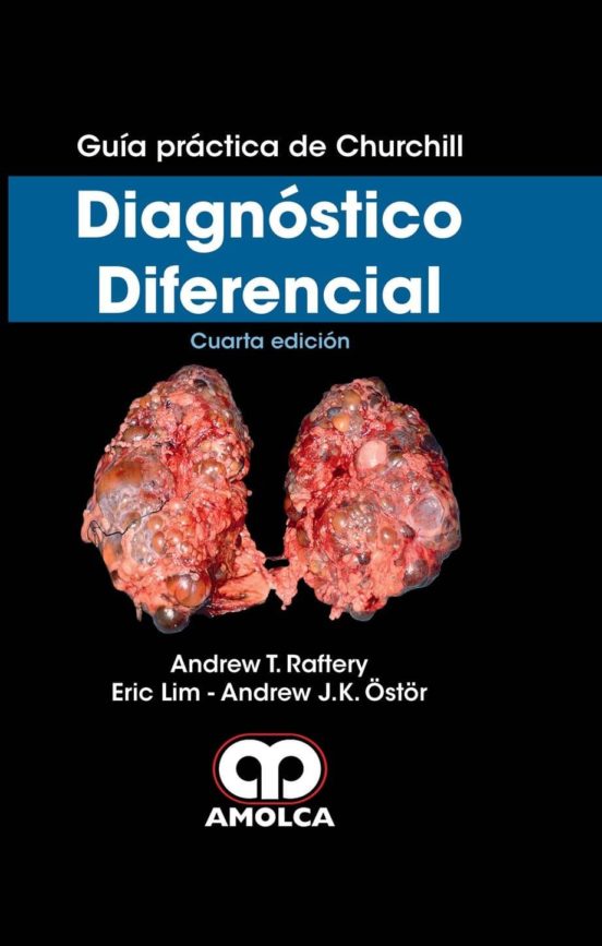 Guia Practica De Churchill: Diagnostico Diferencial