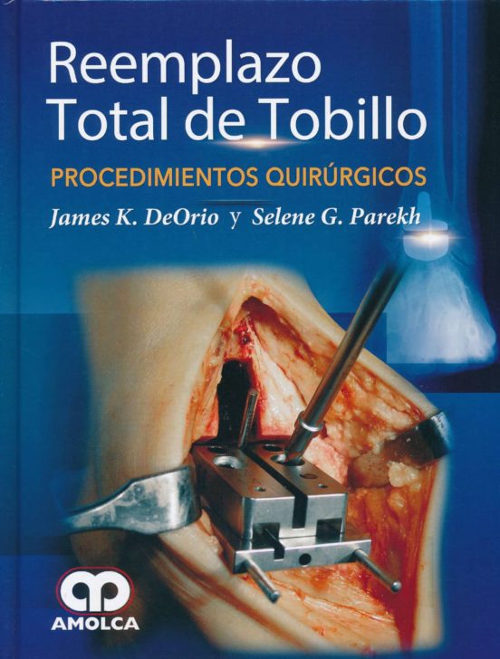 Reemplazo Total De Tobillo: Procedimientos Quirurgicos