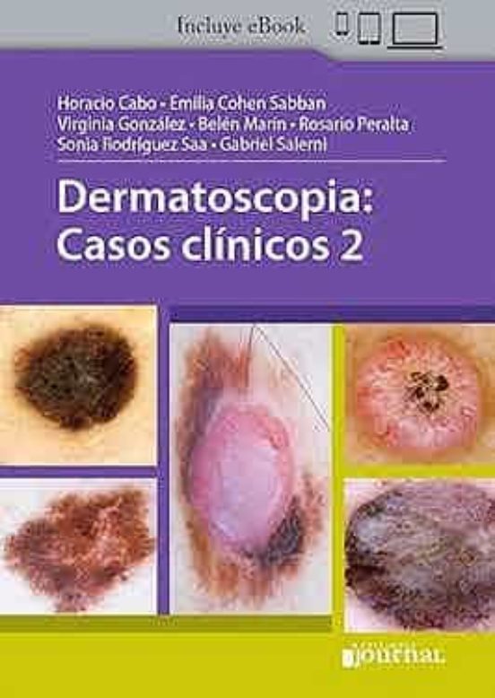 Dermatoscopia: Casos Clinicos 2