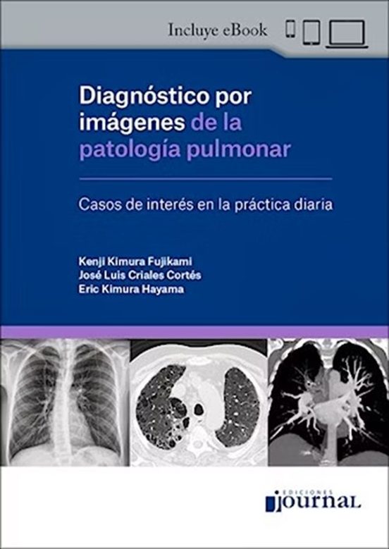 Diagnóstico Por Imágenes De La Patología Pulmonar