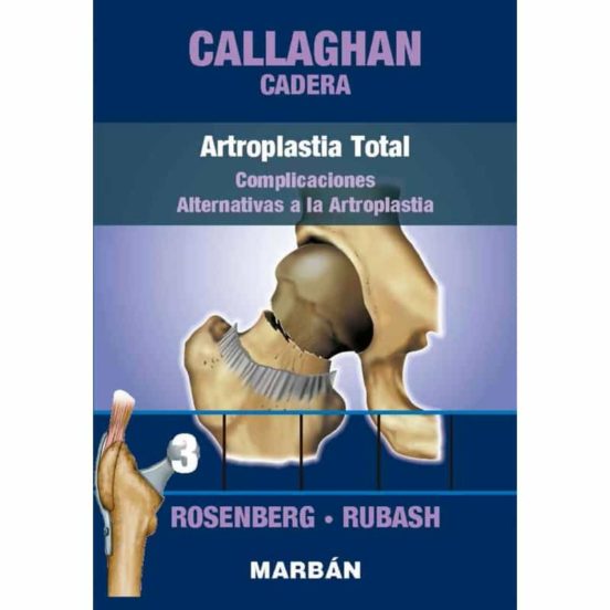 Cadera 3. Artroplastia Total. Complicaciones. Alternativas A La Artrop