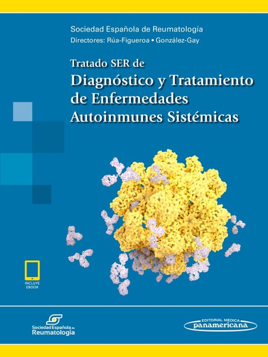Tratado Ser De Diagnóstico Y Tratamiento De Enfermedades Autoinmu Nes