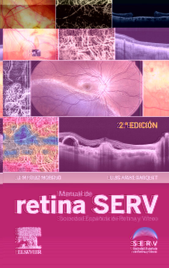Manual De Retina Serv 2ª Ed