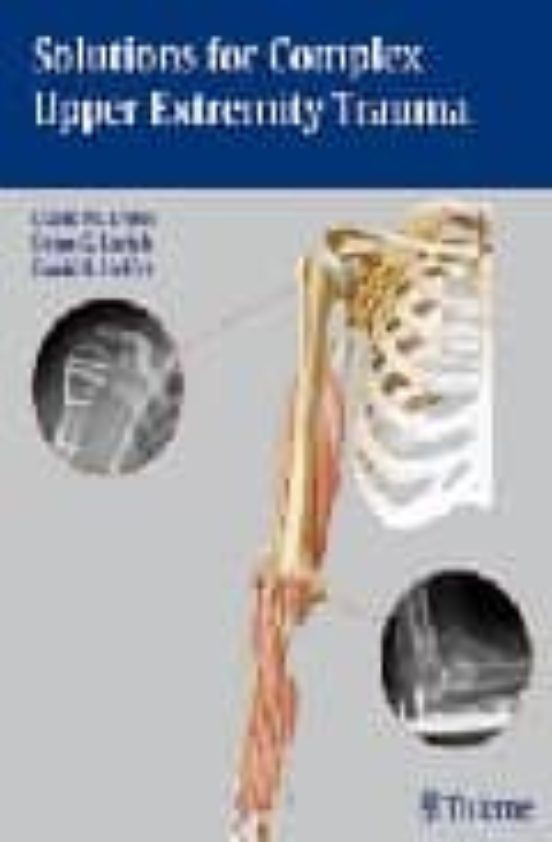Solutions For Complex Upper Extremity Trauma