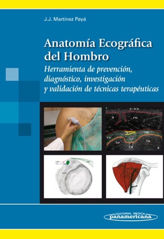 Anatomia Ecografica Del Hombro: Herramienta De Prevencion Diagno Stico