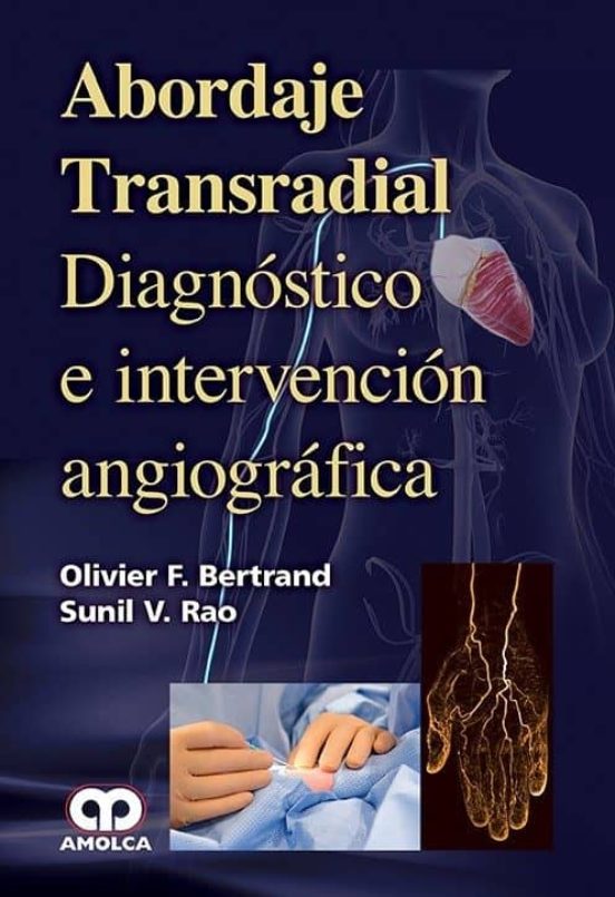 Abordaje Transradial