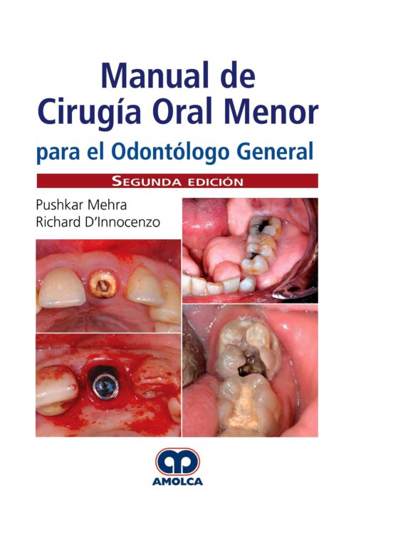 Manual De Cirugía Oral Menor Para El Odontólogo General