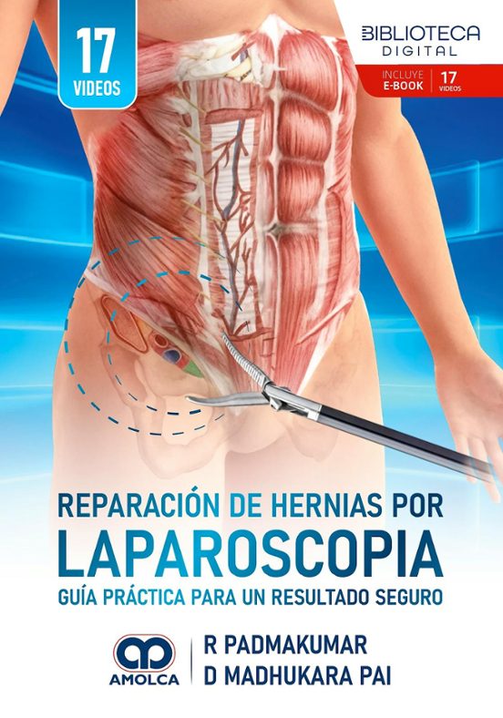 Reparación de hernias por laparoscopia. Guía práctica para un resultado seguro