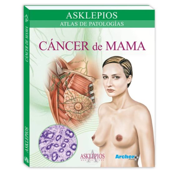 Atlas De Cáncer De Mama