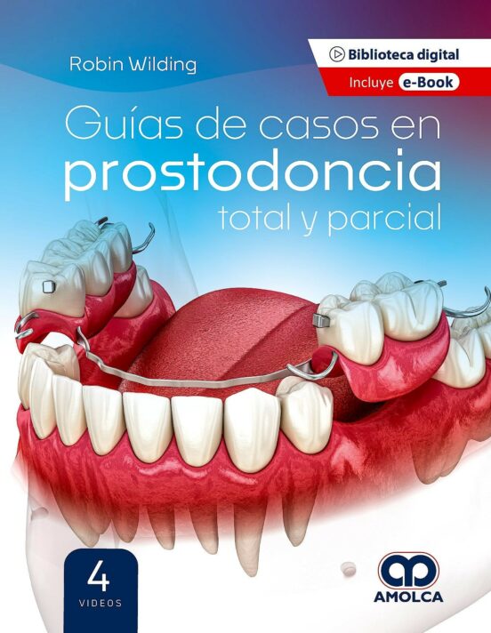 Guías De Casos En Prostodoncia Total Y Parcial