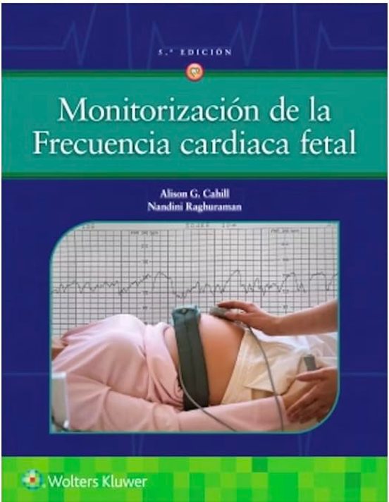 Monitorización De La Frecuencia Cardíaca Fetal