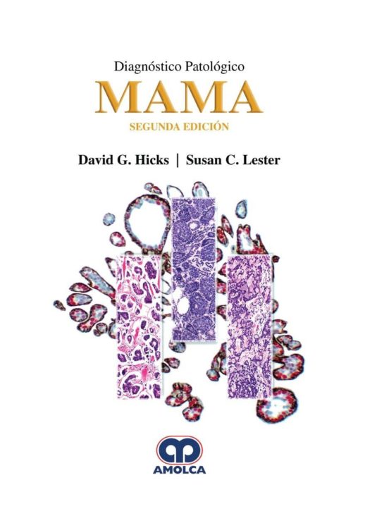 Diagnóstico Patológico: Mama