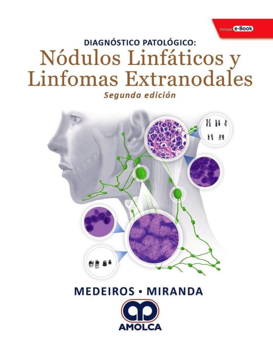 Diagnostico Patologico. Nódulos Linfaticos Y Linfomas Extranodales + E