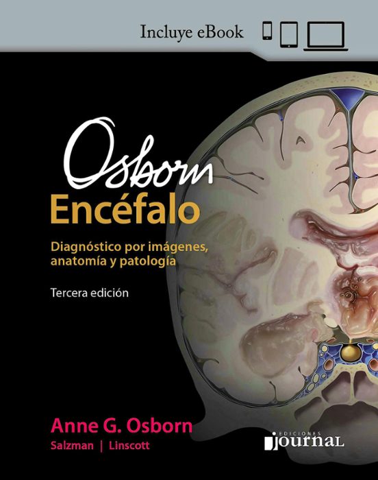 Osborn Encéfalo. Diagnóstico Por Imágenes Anatomía Y Patologia