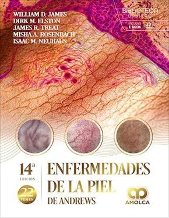 Enfermedades De La Piel De Andrew