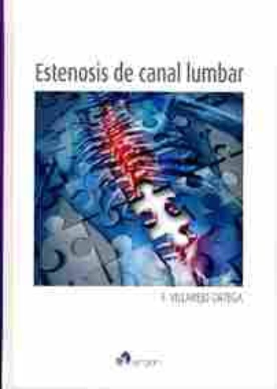 Estenosis De Canal Lumbar