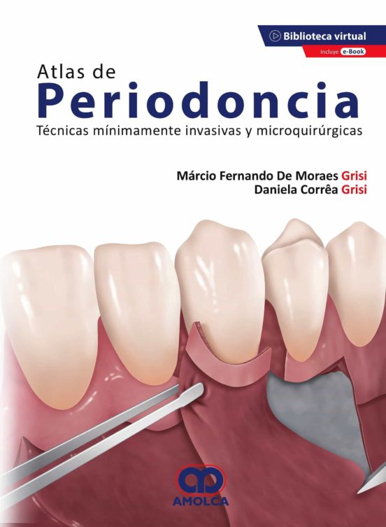 Atlas De Periodoncia. Tecnicas Minimamente Invasivas Y Microquirurgica